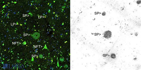 mouse amyloid antibody